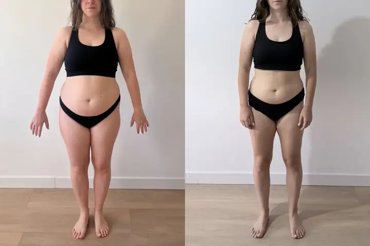 Ariadna antes y después, de frente